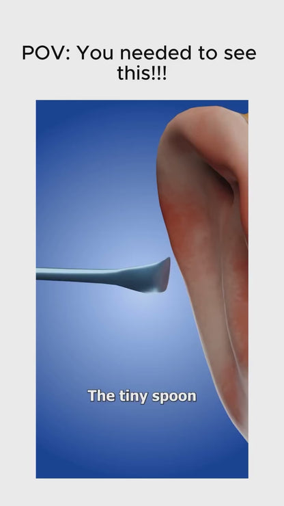 MOMITTLE®  Earwax Removal Tool Kit with HD Camera