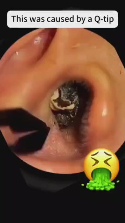 MOMITTLE®  Earwax Removal Tool Kit with HD Camera